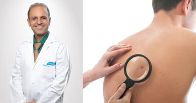 Cosmesurge introduces latest technology for Skin problems